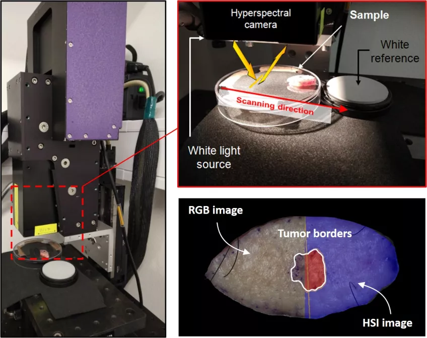 Hyperspectral camera in action while capturing hyperspectral images of an excised skin sample with a tumor. Photo.